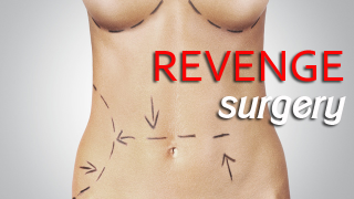 Make Sure Your Divorce Settlement Covers Your Plastic Surgery Costs!